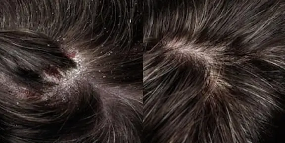 head